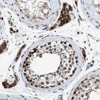 Immunohistochemistry-Paraffin: PRPSAP2 Antibody [NBP1-87341]