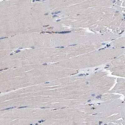 Immunohistochemistry-Paraffin: PRPSAP2 Antibody [NBP1-87341]