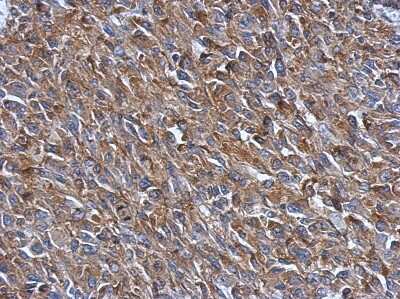 Immunohistochemistry-Paraffin: PRPSAP2 Antibody [NBP2-19966]