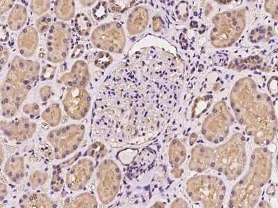 Immunohistochemistry-Paraffin: PRPSAP2 Antibody [NBP2-97949]