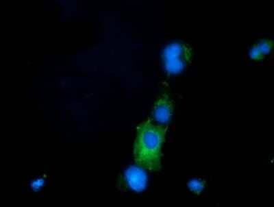 Immunocytochemistry/ Immunofluorescence: PRPSAP2 Antibody (OTI1E3) - Azide and BSA Free [NBP2-73676]