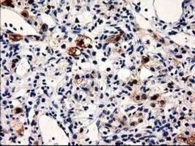 Immunohistochemistry: PRPSAP2 Antibody (OTI1E3) - Azide and BSA Free [NBP2-73676]