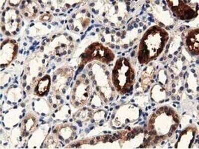 Immunohistochemistry: PRPSAP2 Antibody (OTI1E3) - Azide and BSA Free [NBP2-73676]