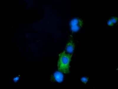 Immunocytochemistry/ Immunofluorescence: PRPSAP2 Antibody (OTI1E3) [NBP2-02893]