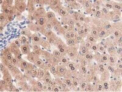 Immunohistochemistry-Paraffin: PRPSAP2 Antibody (OTI1E3) [NBP2-02893]