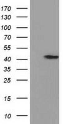 Western Blot: PRPSAP2 Antibody (OTI1E3) [NBP2-02893]