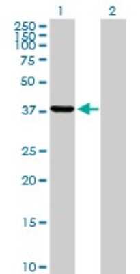 Western Blot: PRPSAP2 Antibody [H00005636-B01P]