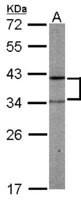 Western Blot: PRPSAP2 Antibody [NBP1-32630]