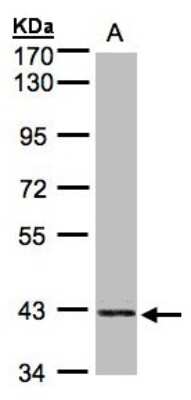 Western Blot: PRPSAP2 Antibody [NBP1-32630]