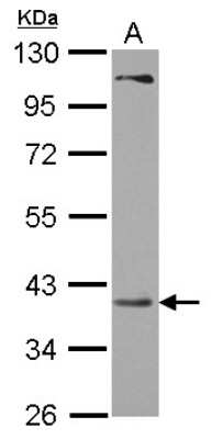 Western Blot: PRPSAP2 Antibody [NBP2-19966]