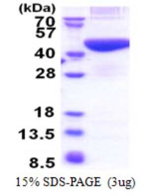 SDS-PAGE: Recombinant Human PRPSAP2 His Protein [NBP2-23331]