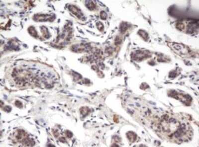 Immunohistochemistry: PRR11 Antibody (OTI2A10) [NBP2-45902]