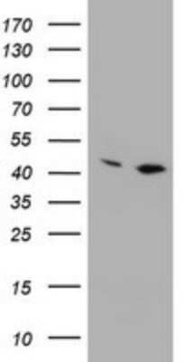 Western Blot: PRR11 Antibody (OTI2A10) [NBP2-45902]