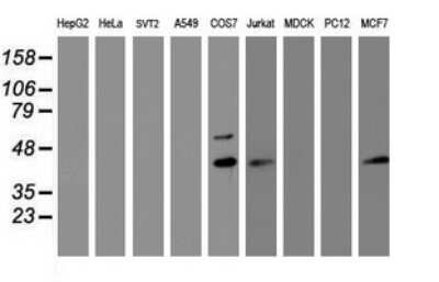 Western Blot: PRR11 Antibody (OTI2A10) [NBP2-45902]