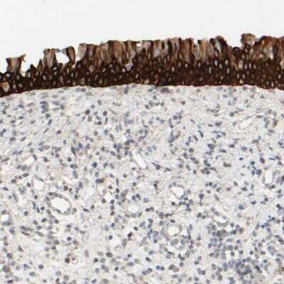 Immunohistochemistry-Paraffin: PRR11 Antibody [NBP1-83784]