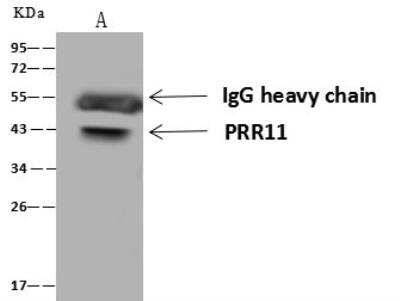 Immunoprecipitation: PRR11 Antibody [NBP3-12614]