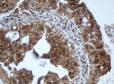 Immunohistochemistry: PRR11 Antibody (OTI2A10) - Azide and BSA Free [NBP2-73677]
