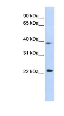 Western Blot: PRR11 Antibody [NBP1-55346]