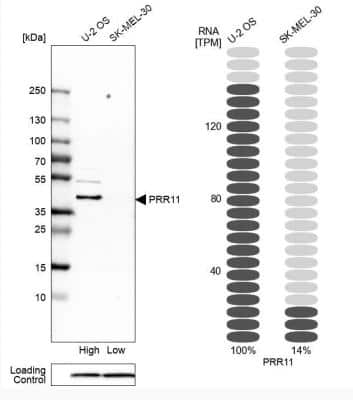 Western Blot: PRR11 Antibody [NBP1-83784]