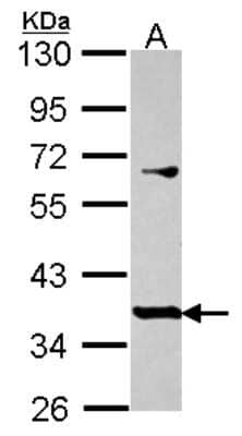 Western Blot: PRR11 Antibody [NBP2-19967]