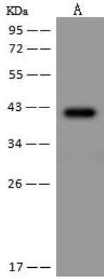 Western Blot: PRR11 Antibody [NBP3-12614]