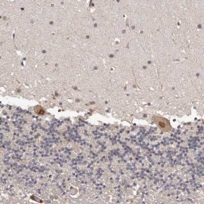 Immunohistochemistry-Paraffin: PRR12 Antibody [NBP1-93595]