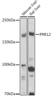 Western Blot: PRR12 AntibodyAzide and BSA Free [NBP3-16049]