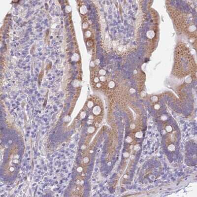 Immunohistochemistry-Paraffin: PRR13 Antibody [NBP1-92299]