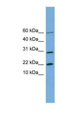 Western Blot: PRR13 Antibody [NBP1-57593]