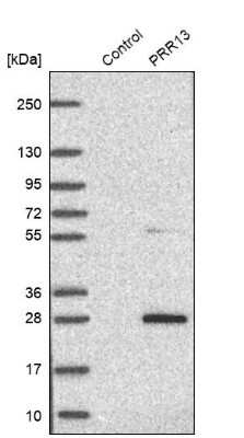 Western Blot: PRR13 Antibody [NBP1-92299]