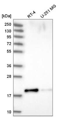 Western Blot: PRR13 Antibody [NBP2-55384]