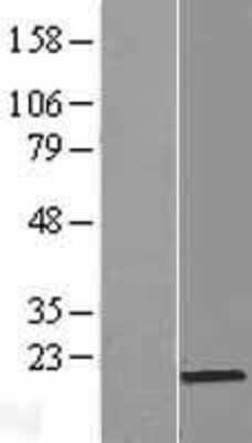 Western Blot: PRR13 Overexpression Lysate [NBL1-14832]