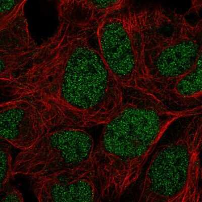 Immunocytochemistry/ Immunofluorescence: PRR14 Antibody [NBP2-58105]