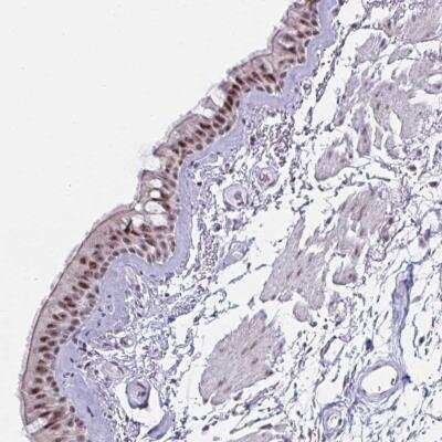 Immunohistochemistry-Paraffin: PRR14 Antibody [NBP2-31812]