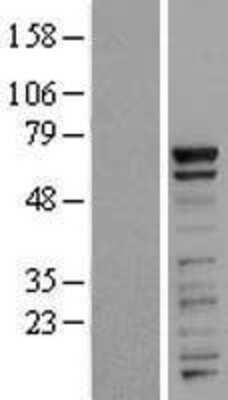 Western Blot: PRR14 Overexpression Lysate [NBL1-14833]