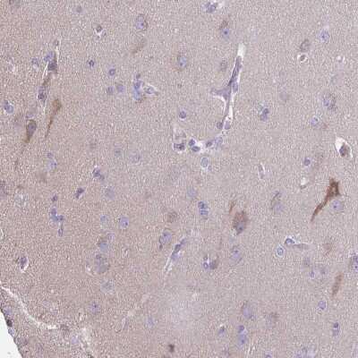 Immunohistochemistry: PRR14L Antibody [NBP2-38968]