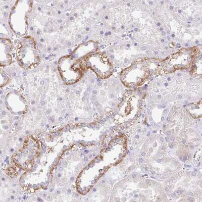 Immunohistochemistry-Paraffin: PRR14L Antibody [NBP2-38968]