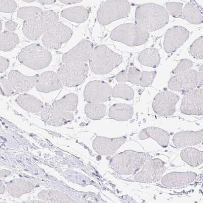 Immunohistochemistry-Paraffin: PRR14L Antibody [NBP2-38968]