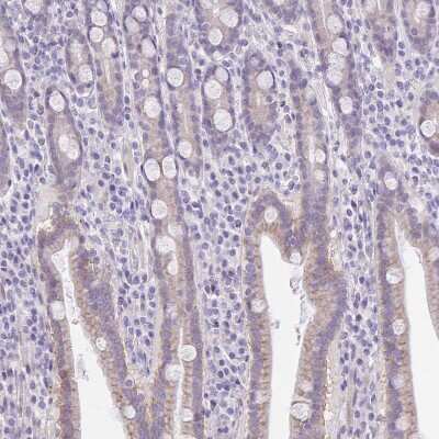 Immunohistochemistry-Paraffin: PRR14L Antibody [NBP2-38968]