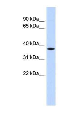 Western Blot: PRR14L Antibody [NBP1-70464]