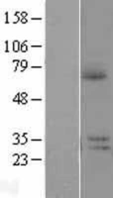 Western Blot: PRR14L Overexpression Lysate [NBP2-05119]