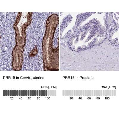 Immunohistochemistry-Paraffin: PRR15 Antibody [NBP2-30799]