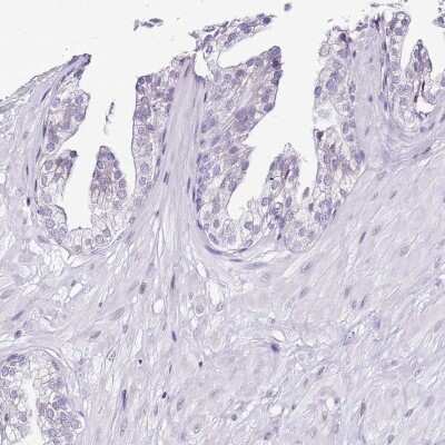 Immunohistochemistry-Paraffin: PRR15 Antibody [NBP2-30947]