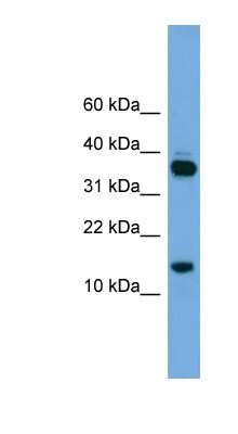 Western Blot: PRR15 Antibody [NBP1-56966]