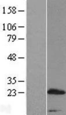 Western Blot: PRR15 Overexpression Lysate [NBL1-14834]