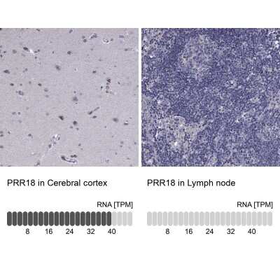Immunohistochemistry-Paraffin: PRR18 Antibody [NBP2-62715]