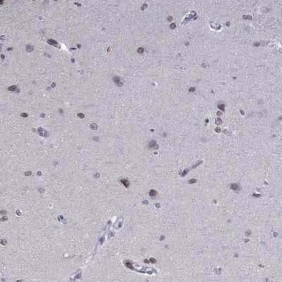 Immunohistochemistry-Paraffin: PRR18 Antibody [NBP2-62715]