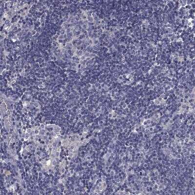 Immunohistochemistry-Paraffin: PRR18 Antibody [NBP2-62715]