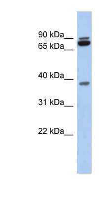 Western Blot: PRR19 Antibody [NBP1-70686]