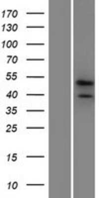 Western Blot: PRR19 Overexpression Lysate [NBP2-04625]